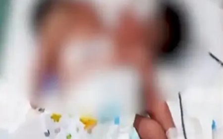 Baby Born with Two Heads in Odisha’s Kandhamal, Receives Specialised Medical Care